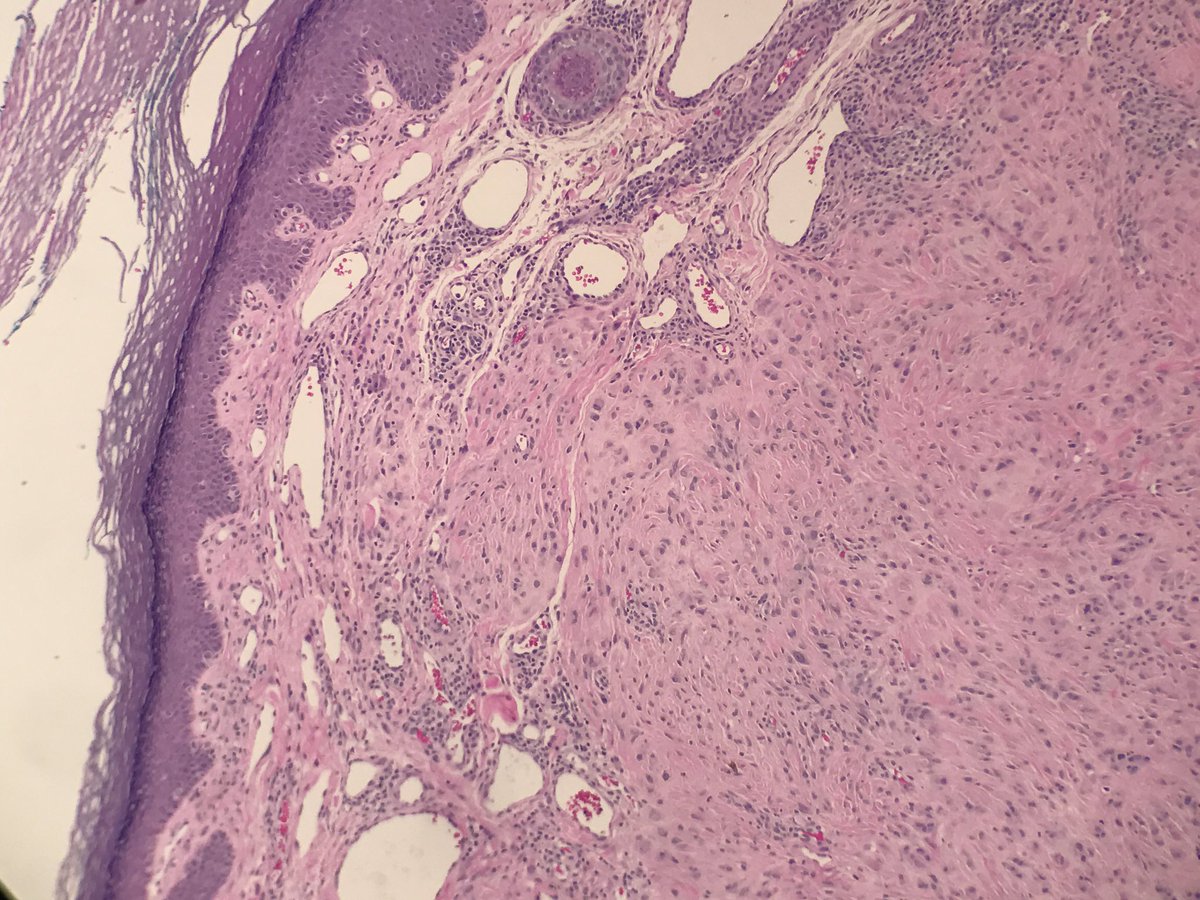 BSTPath tweet picture