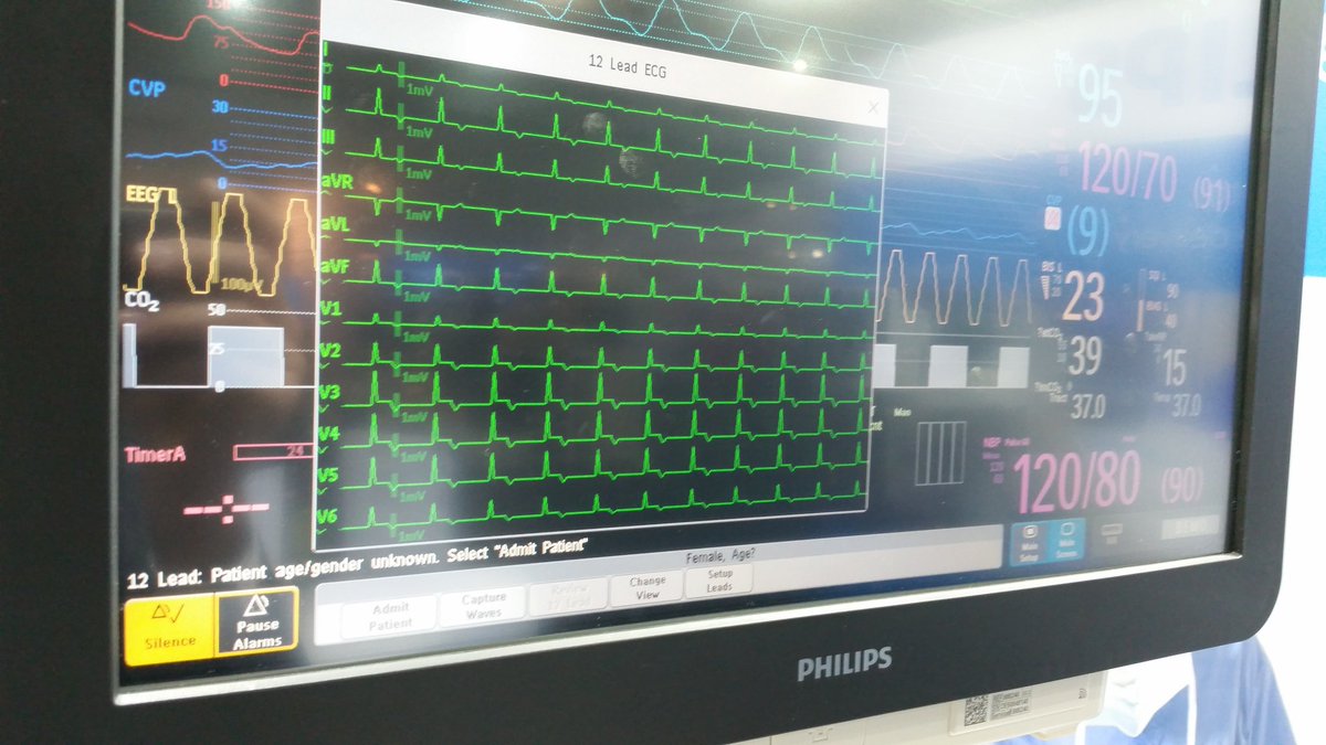 izmircongo's tweet photo. Another great day at #ASM17BRIS today. Masterclass on 12ld ECG without leaving the OR at the #philips  booth lunchtime today. @ANZCA https://t.co/sn2ZvTm2cM