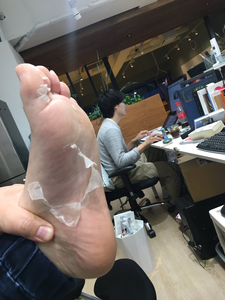 かんち Twitterren モンゴルナイフが紹介してたベビーフットを試してみたんですけど 4日目でめっちゃ剥けてきた ズルむけ 足裏カチカチなのでベビーフットで足の皮をむいてみた ヌートン 新たな情報未発見メディア T Co Vvvq7vgoce T Co かんち Twitterren モンゴルナイフが紹介してたベビーフットを試してみたんですけど 4日目でめっちゃ剥けてきた ズルむけ 足裏カチカチなのでベビーフットで足の皮をむいてみた ヌートン 新たな情報未発見メディア T Co Vvvq7vgoce T Co
