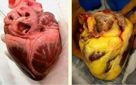 corazon