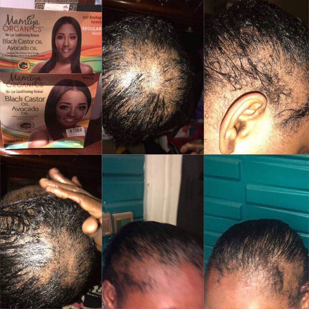 timeyinxo's tweet photo. Please if you ever see this relaxer in the market do not buy it! It's fake and will make your hair fall off. Please RT for awareness https://t.co/kqnwsCwrcV