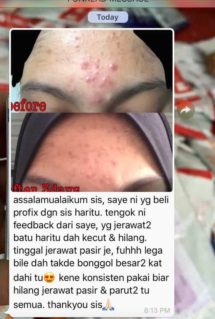 ProfixJohor's tweet image. 📣📣SIAPA NAK JADI GENG MUKA CANTIK MASA RAYA? ANGKAT TANGAN!! 📣📣📣

Berminat? Sila whatsapp 0127479928

#profix #profixjb #profixpasirgudang