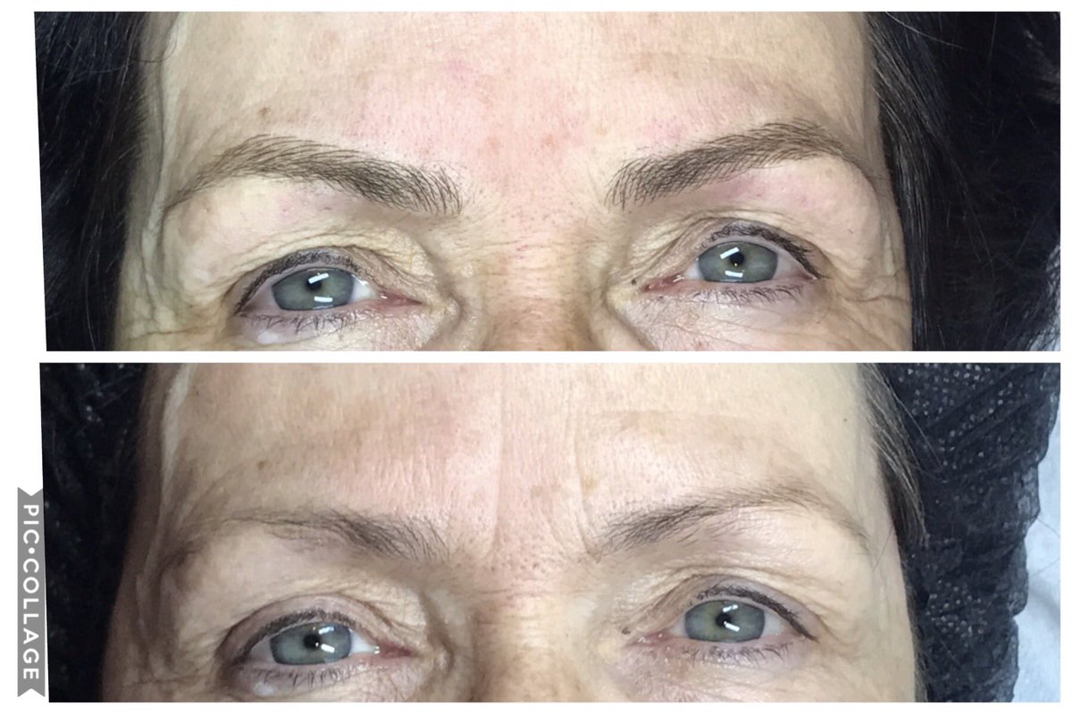 SharnaBone's tweet photo. microblading 
Pleased to say my mam is happy 
How fab is this treatment 
#fullbrow #microblading @geminihairbeau2 https://t.co/GsLgMPsHFR