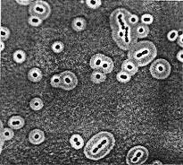 Клетки большинства бактерий можно. Бактериальная клетка в микроскопе. Микроскопирование бактериальных клеток. Капсула бактерий микробиология. Капсула бактерии микроскопия.