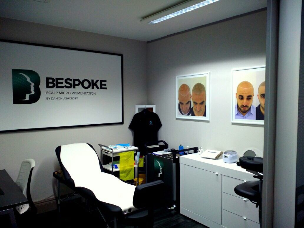 Bespoke SMP BY Damon on Twitter "Bespoke Scalp Micro Pigmentation by Damon Ashcroft at Optima