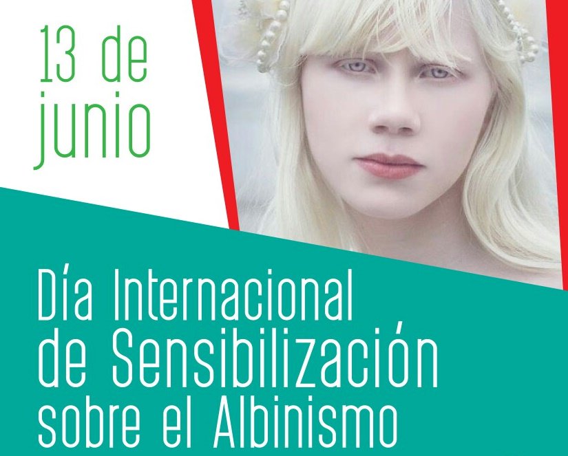 CherokeeEnLinea's tweet photo. Las personas con albinismo son discriminadas en muchas partes del mundo. Son víctimas de la ignorancia de la sociedad. #NoDiscrimines https://t.co/4KhAdC8q44