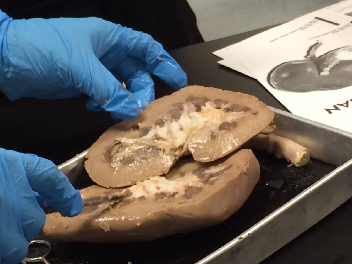 AJ Arnold tweet media