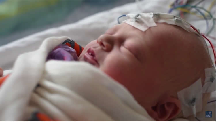 Using Simple Brain Scan to Detect Pain in Infants neurosciencenews.com/eeg-pain-infan… #eeg #pain #neuroscience #science