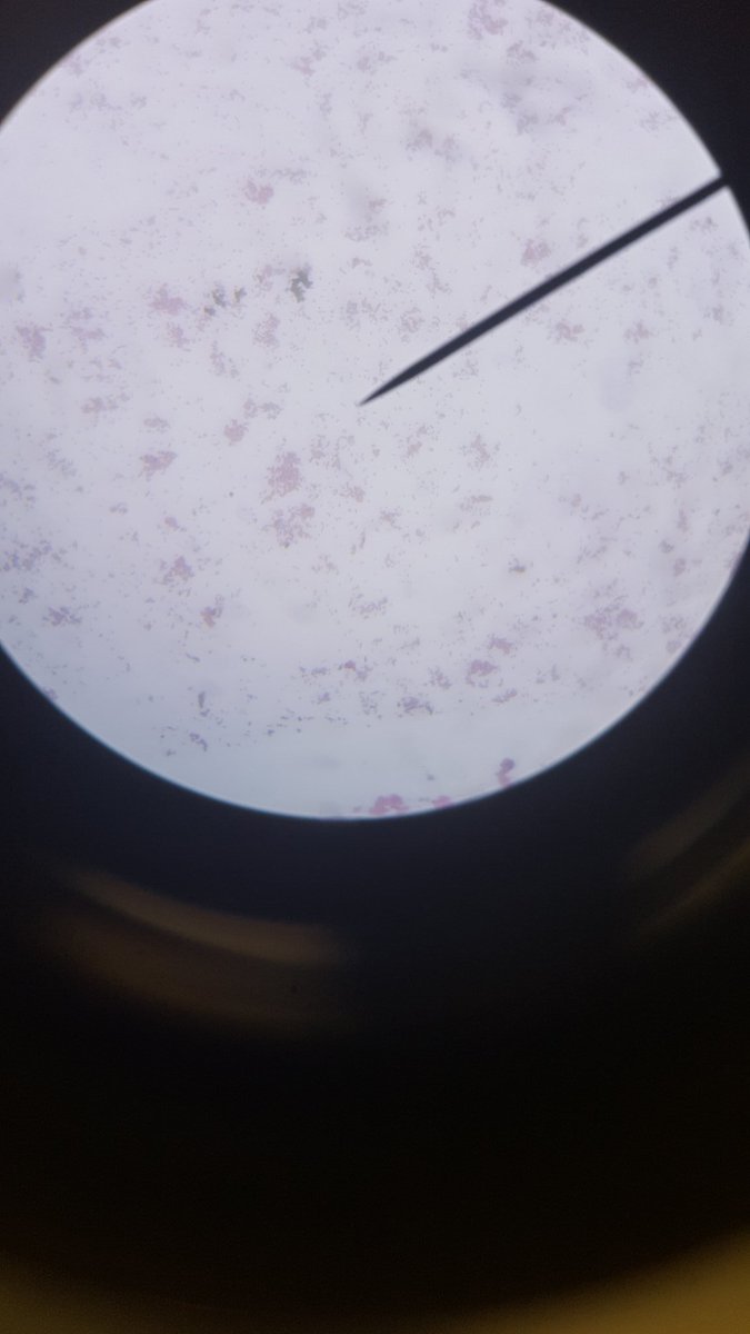 KenzieDreamer01's tweet photo. Gram Staining with @WCHSBioMed https://t.co/cLLzIxc1QL