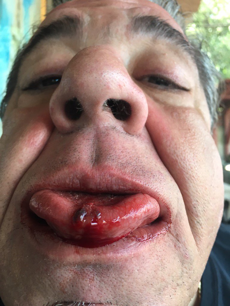 madflavor's tweet photo. At the emergency room... that pussy had a mouse trap in it..... https://t.co/WoAeTOw8jW
