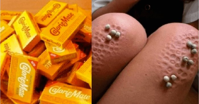 乗っ取られ リムれー 危険注意 朝食と昼食を カロリーメイトだけの生活 を 約５ヶ月間 続けた結果がヤバすぎる T Co Stzmduep9d これは危なすぎる