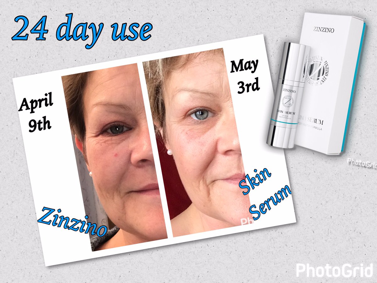 zinzino skin serum