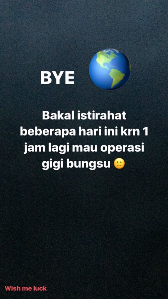 _IFCMedan's tweet photo. Si cantik @ifyalyssa abis operasi gigi bungsu. Lekas sembuh, teteh!😘 https://t.co/AAlS0TU1en