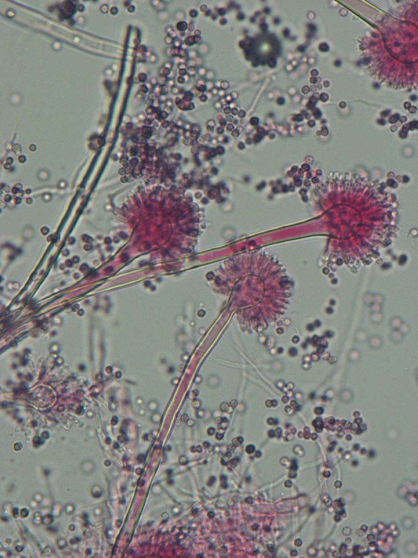 It is nearly time for the #NCPF yearly training course - Identification of pathogenic fungi. 
#MedicalMycology bit.ly/2ok6cDd