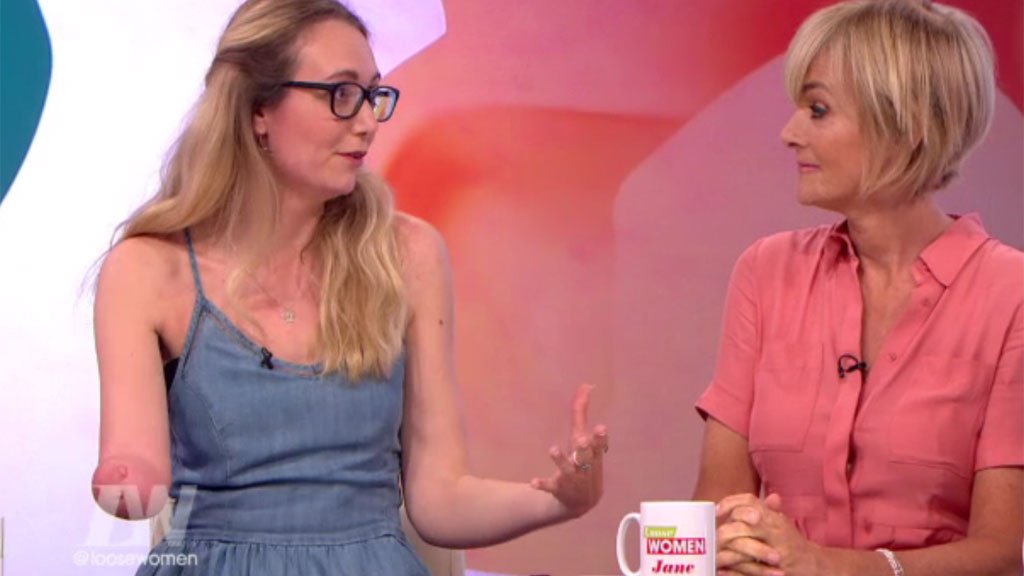WeAreSTV's tweet photo. .@cerrieburnell shares her #BodyStory with #LooseWomen & talks prejudice she's faced in the past: https://t.co/x7OgpU244z #MyBodyMyStory https://t.co/LzwVbywW6R
