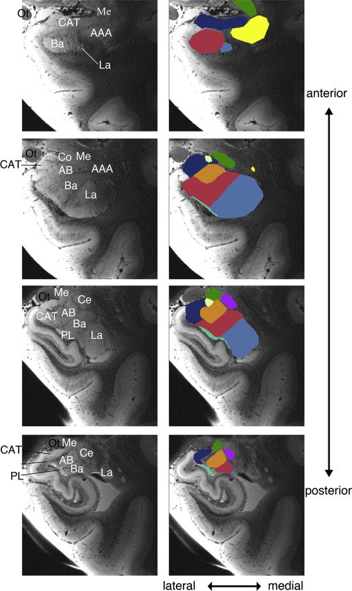 "High-resolution MRI reveals nuclei of the human amygdala: manual segmentation to automatic atlas" sciencedirect.com/science/articl…
