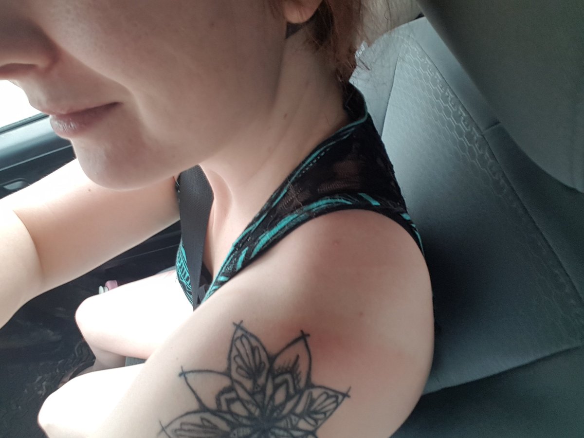 PowerKi77en's tweet photo. First sunburn of the season and I was wearing sunscreen #whitekidproblems #summer https://t.co/rqOGcw2OB7