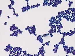 rheumaticfev17's tweet photo. Decided to go swimming in the gram-stain pool. I hate the peptidoglycan in my cell wall, I look bad in purple. #yuck #hate https://t.co/sySdABay6H