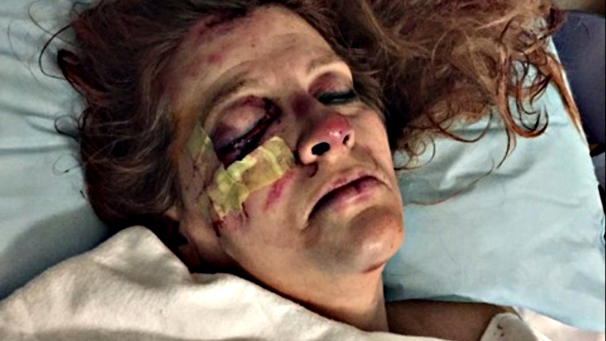 TheDoctors's tweet photo. A woman who was attacked by her husband &amp; dragged by a car in front of her kids shares her harrowing story. https://t.co/VrBcskkTFX https://t.co/NiiDPcfoM0