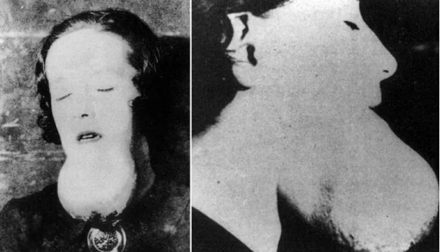 The forgotten story of the Radium Girls, whose deaths saved thousands of workers' lives
bzfd.it/2qLN5U0