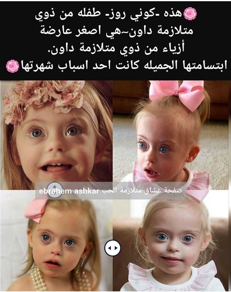 كوني روز احدى اطفال #متلازمة_داون تتميز بابتسامه جميله اكتسبت شهره في مواقع التواصل الاجتماعي كصاحبه اجمل عيون👁💚💚