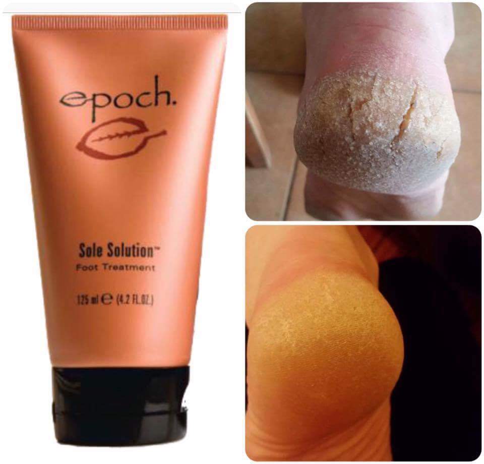 PerfectYOU23's tweet image. Epoch Sole Solution 👌