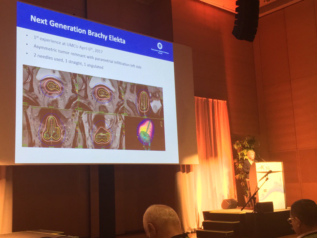 eyloar's tweet photo. Dr. Ina Schulz from Utrecht Medical Center reports on her first experiences with Venezia #ESTRO36 #Elekta #gynbrachy https://t.co/BdxXFmeL47
