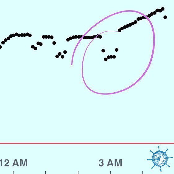 erinspineto's tweet photo. I love it when my @Dexcom takes a moment out of his hard working day to show a little empathy for the rough night I had. #diabetesproblems https://t.co/0im0w5M8PO