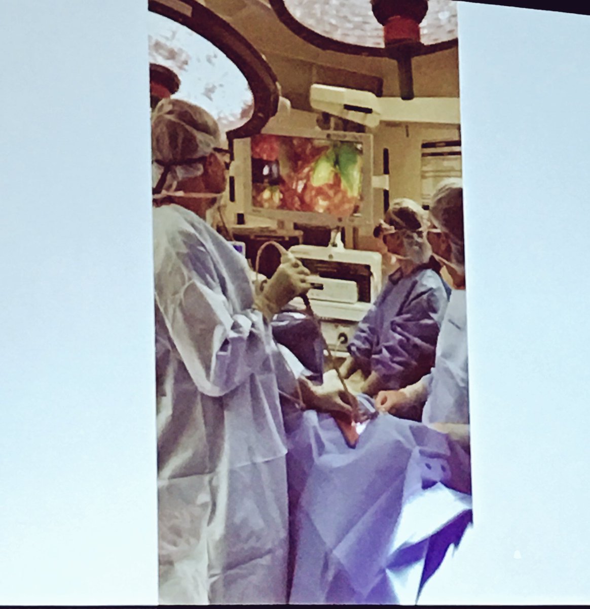 StrykerBreast's tweet image. .@MichaelBouvet showcasing the use of PINPOINT #FluorescenceImaging in a #Parathyroidectomy. #iSPIES