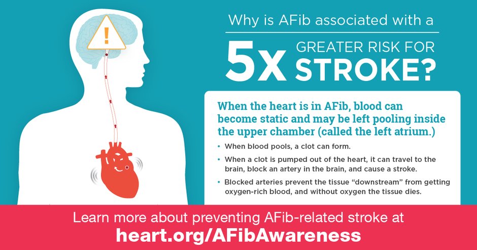 American_Heart's tweet image. Why does atrial fibrillation increase your risk for stroke? Can you tell when you’re going to have an AFib episode?  spr.ly/601785FvB