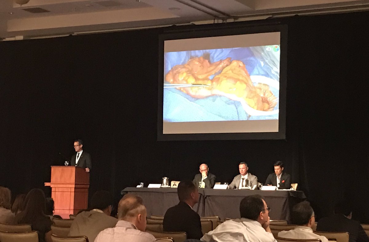 JCglowsGREEN's tweet image. @MichaelStamos presents on first #SPYPHI surgery in US - Proud moments @NOVADAQTech!! #iSPIES #surgtweeting