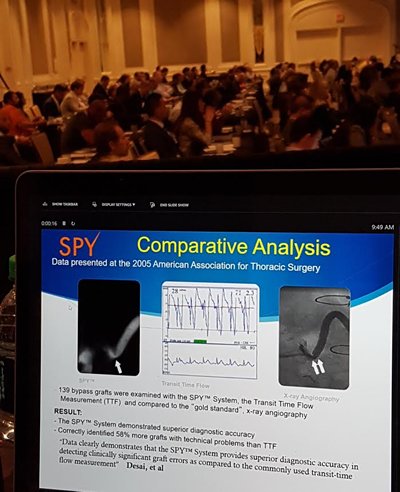 StrykerBreast's tweet image. 'Data has shown that SPY provides superior diagnostic accuracy in detecting graft errors as compared to TTFM' -Dr. Muehrcke #CABG #iSPIES