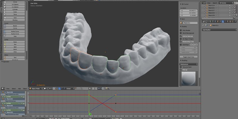 StarzykLaura's tweet photo. This guy fixed his teeth by 3D printing his own plastic braces for $60 https://t.co/f8AixOlkdZ by #businessinsider via @c0nvey https://t.co/V9SnxnlxnL