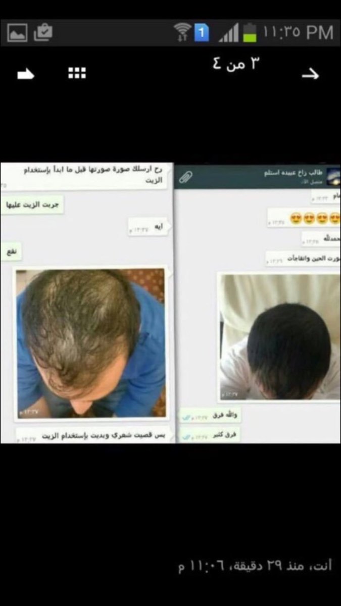 tswq22's tweet photo. زيت الشعرالاصلي افغاني خام اسود
علاج
للصلع
القشره
تساقط الشعر
يقوي الجذور.
يعطي لمعان يعالج مشاكل الدقن والفراغات👍🏻
ج/0535696658 https://t.co/upstTPT3yP