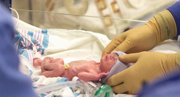 Erken Doğum Nedenleri Nelerdir? Erken Doğum Riskli Mi? kadinvehastaliklari.com/erken-dogum-ne…