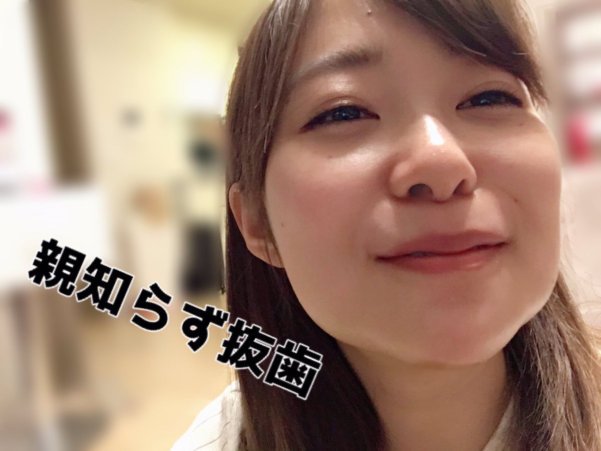 指原莉乃が親知らずを4本抜く 顔が腫れた写真公開しファンに衝撃 ライブドアニュース 指原莉乃が親知らずを4本抜く 顔が腫れた写真公開しファンに衝撃 ライブドアニュース