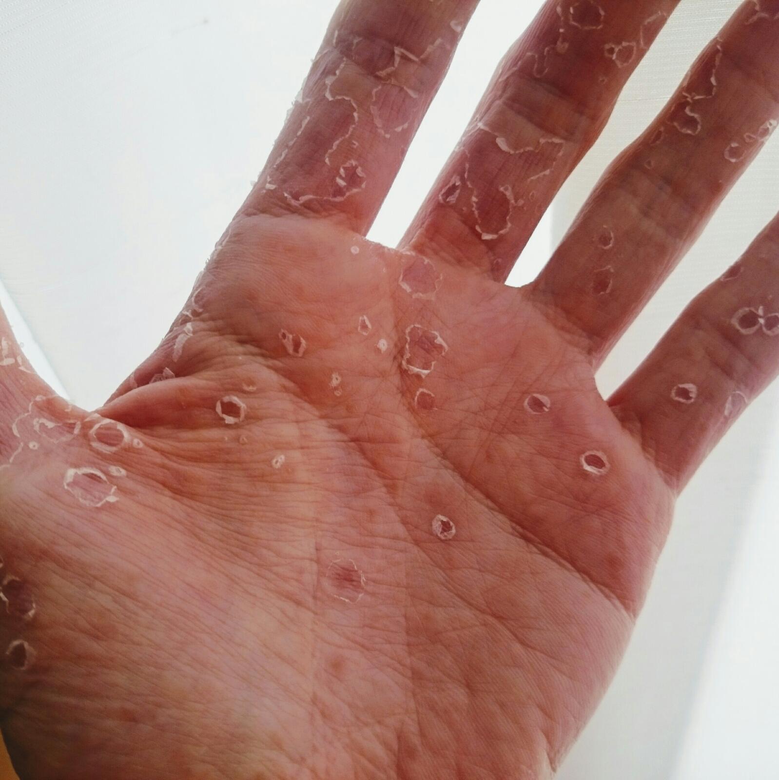 ちま 手のひらが蓮コラorz T Co Vuvrlcsbxk Twitter