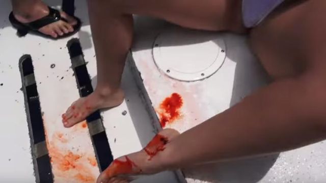 IAmSonyaBlade's tweet photo. Molly Cavalli, an adult actress was bitten by a shark while testing underwater a new technology for streaming ... - https://t.co/L3Ba2Z2hgQ https://t.co/PiJe2oKFCg