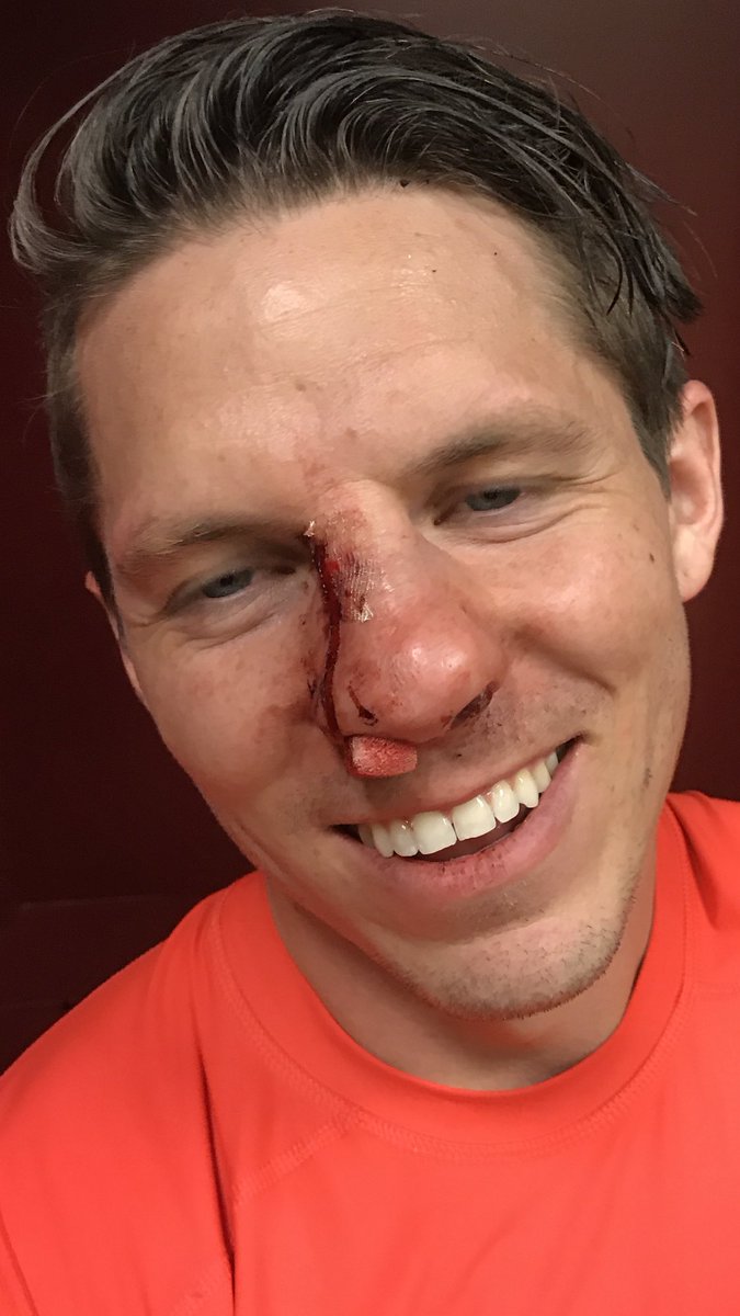 Happy for the man of the match @ShuttleworBobby . Clean sheet and 8 saves. Broken nose 👃🏼 but kept on doing his job. 👊🏻
#character 
<a href="/MNUFC/">x - Minnesota United FC</a>