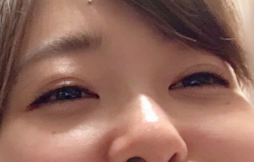 まさーし בטוויטר 画像 指原莉乃さん 親知らずを4本抜いて顔の形が変形してしまう T Co Kiufhioieo