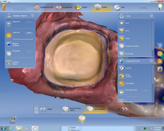 "I love having the ability to correct my mistakes quickly, thanks to my CEREC." Read more: cdocs.education/2p1AO1j #dentistry #cerec #dental