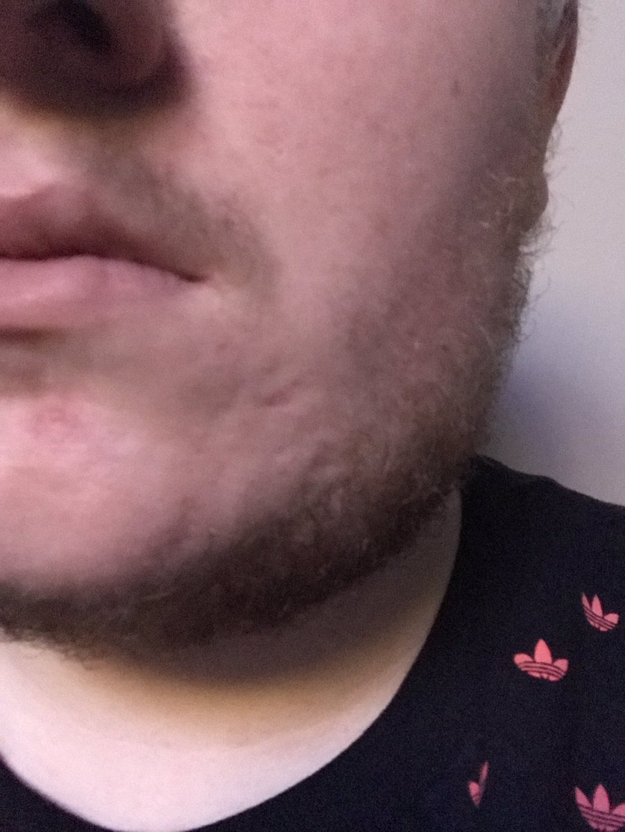 nudah tweet picture