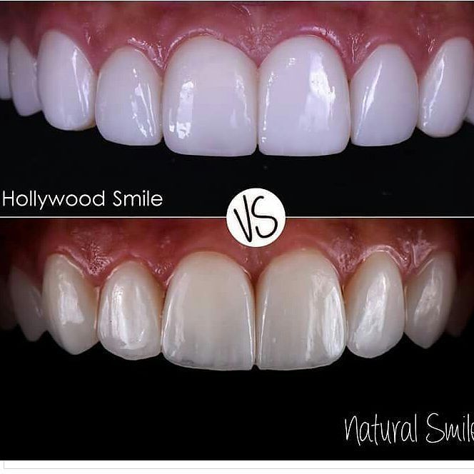 notasdentales's tweet photo. #ndent #dentistry #dentista #odontology #odontologia #stetic 👌👌👌 https://t.co/DjBzZ9wtiK