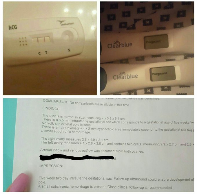 It's been a year but it seem like it was only a couple hours ago when I  found out about you☺️ https://t<a href="/tag/newprofilepic"class="tags"><span>#newprofilepic</span></a>
