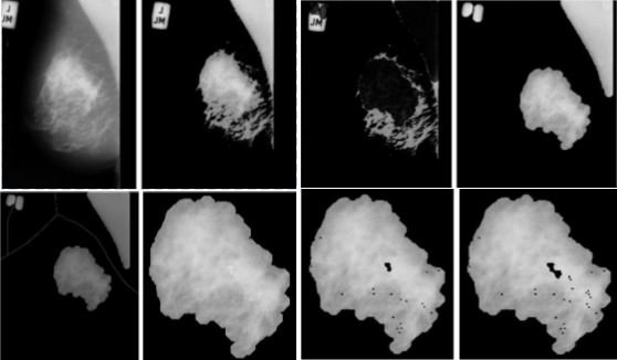 OUTechTransfer's tweet photo. System for early, accurate detection of #microcalcifications in #mammograms could improve #breastcancer outcomes. https://t.co/MtCaw212Nh https://t.co/2lRyMpkJfB