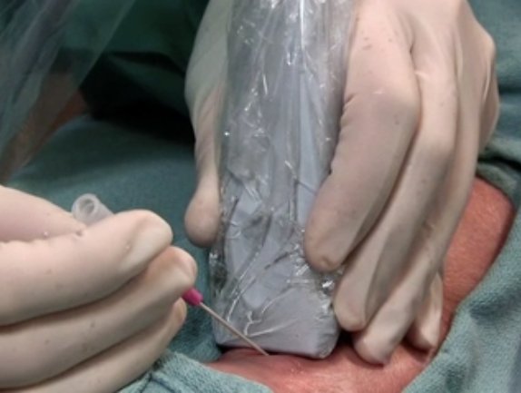 UMichSurgery's tweet photo. Today's #UMInternBootcamp-the often exciting, frequently humbling, radial a-line-Dont forget the Allen's Test! @NEJM https://t.co/uleknVcjFq https://t.co/KBIje9wj6p