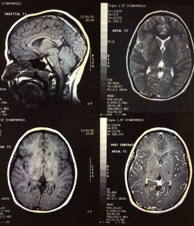 centralnebraska's tweet photo. Here are a few reasons why your #doctor might suggest an Open #MRI: https://t.co/kQ3uFKltYc https://t.co/s6ttEm1eVi