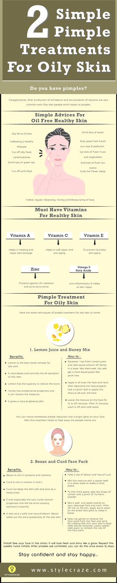 DeadSeaMagicTM's tweet image. 16 Hacks, #Tips_and_Tricks On How To Deal With Oily #Skin