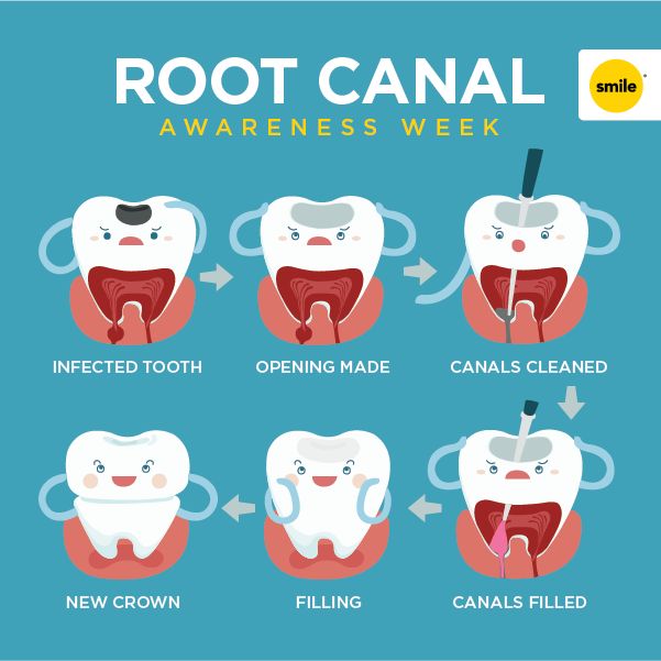 SashaConly's tweet photo. Guess what week it is?  Make sure you are aware of how your teeth CAN be saved- with new technology this procedure can be painless! https://t.co/lpgXPOCbxG