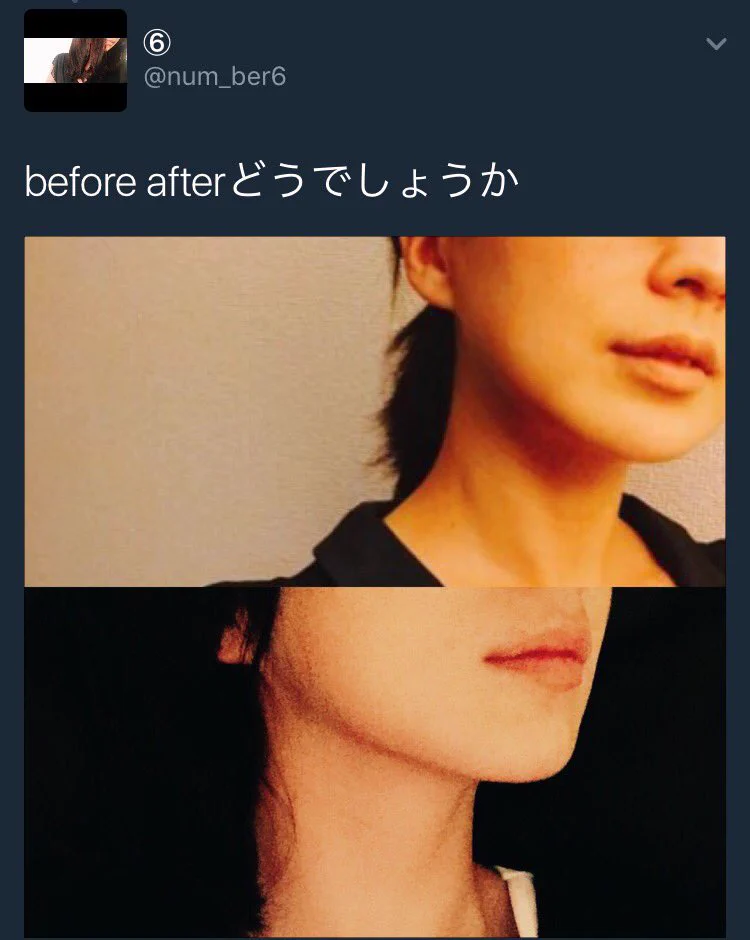 毎日うがいを習慣づけるだけで顎痩せ確実！上手にうがいして顎痩せしましょう！